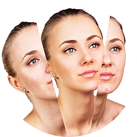 facial Rejuvenation Bloomfield NJ