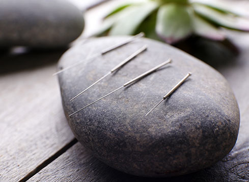 Acupuncture To Serenity